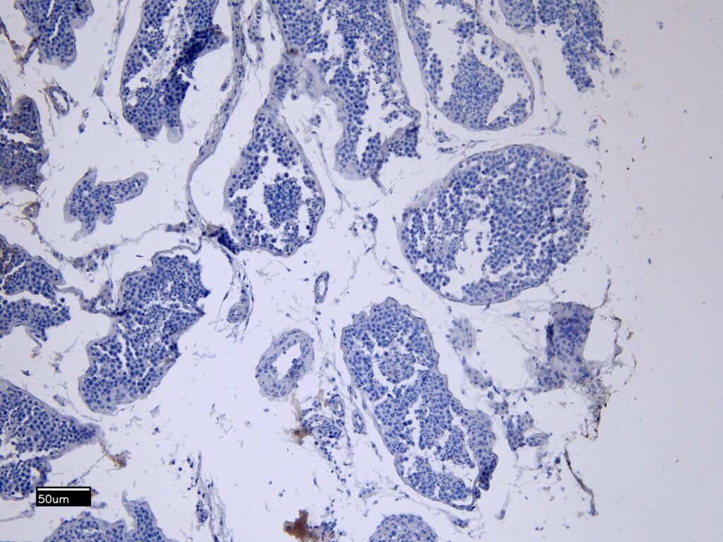 Negative Control showing staining of paraffin embedded Human Testis