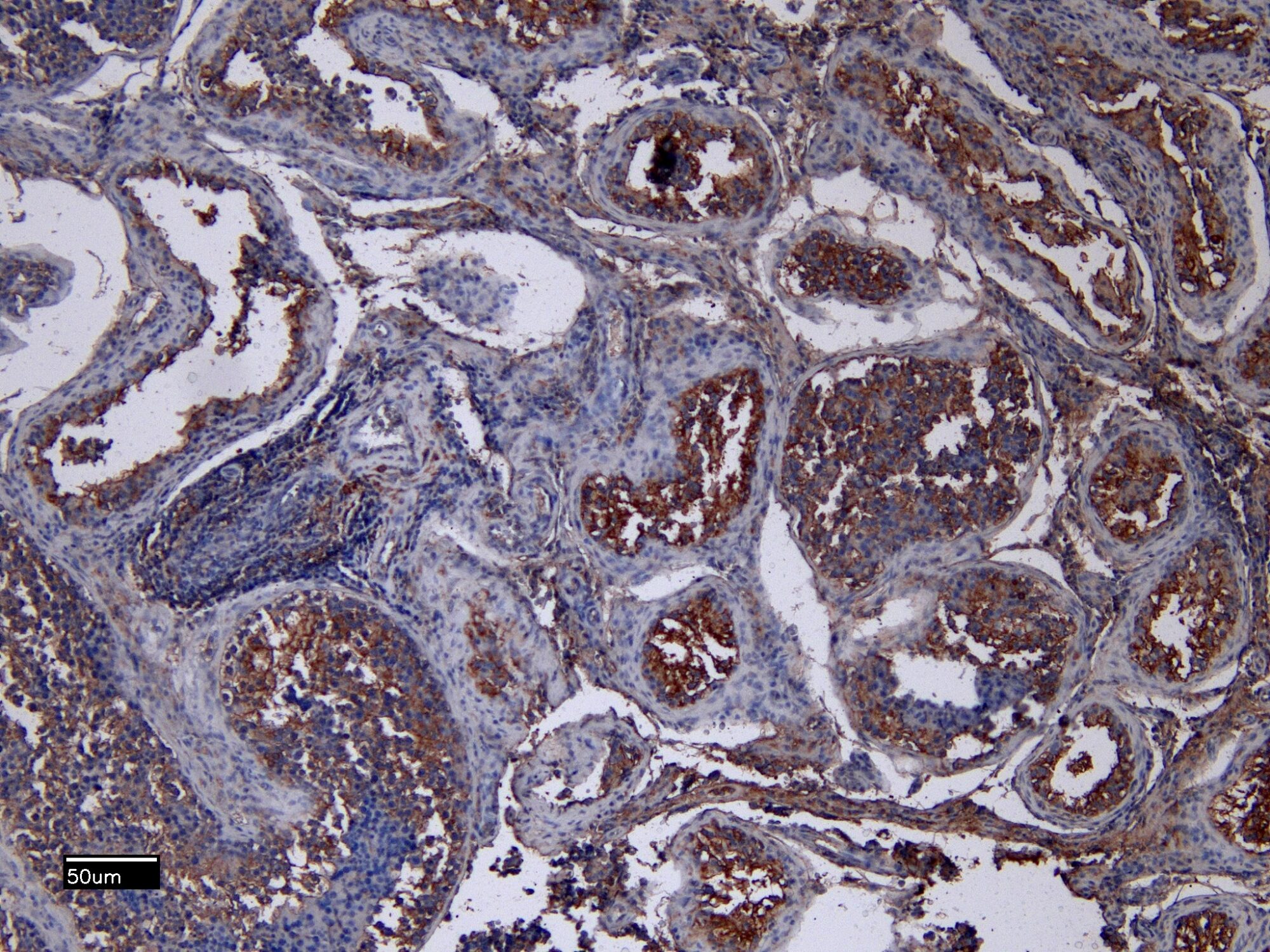 EB13087 (8µg/ml) staining of paraffin embedded Human Testis