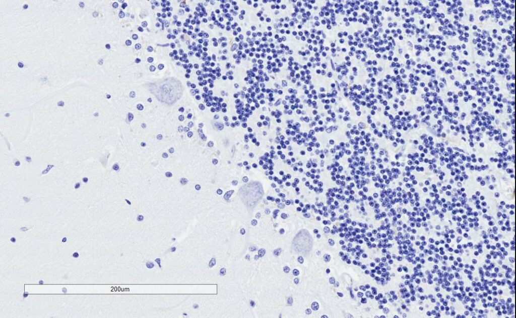 EB09800 Negative Control showing staining of paraffin embedded Human Cerebellum