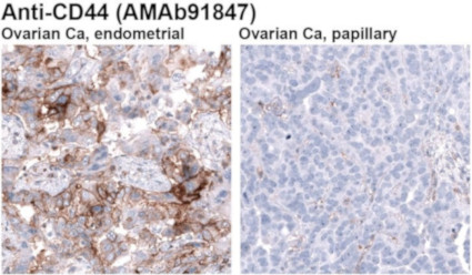 Anti-CD44 monoclonal antibody (AMAb91847)
