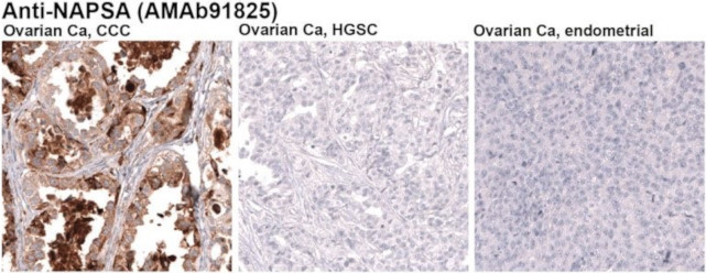 Anti-NAPSA monoclonal antibody (AMAb91825)