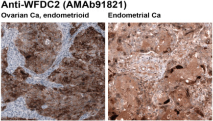 Anti-WFDC2 (AMAb91821)