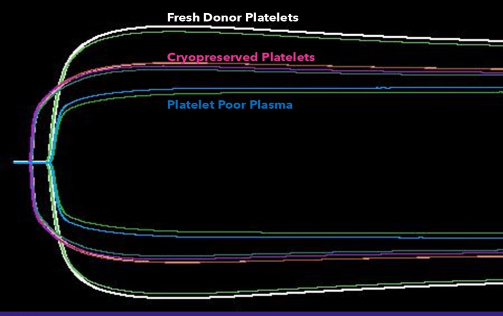 Kaolin-initiated, thromboelastography by PRP, PPP/PCPS and a single lot of cryopreserved platelets in NPP.
