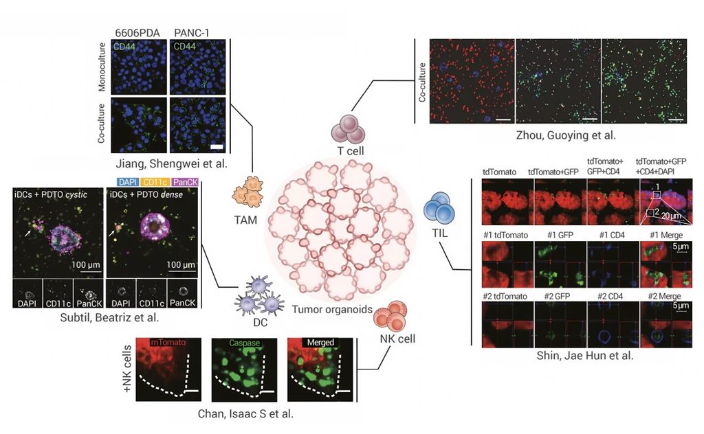 Diagram of future tumor organoid co-culture models showing interactions between tumor organoids and immune cells, including T cells, NK cells, dendritic cells, TAMs and TILs.